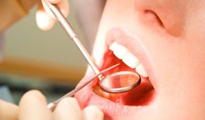 Bad Oral Habits 300x175 - Reasons to Quit Bad Oral Habits