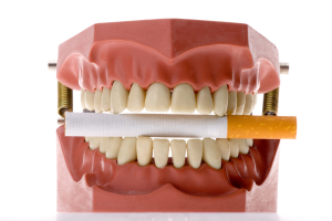 The Terrible Effects of Tobacco Heavy Drinking to Dental Health 300x200 - The Terrible Effects of Tobacco &amp; Heavy Drinking to Dental Health