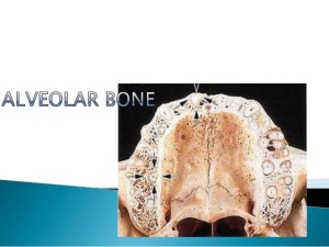 Significant Info of Alveolar Bone 300x225 - Significant Info of Alveolar Bone