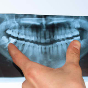 Periodontist Your Gum Health Expert 2 300x300 - Periodontist: Your Gum Health Expert