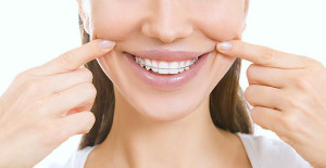 Whats With Retainer Therapy 300x155 - What's With Retainer Therapy?