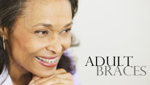Adult Braces The Smile Booster for Grownups 300x169 - Adult Braces - The Smile Booster for Grownups