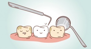 Calculated Cause Effects of Dental Calculus2 300x163 - Calculated Cause &amp; Effects of Dental Calculus